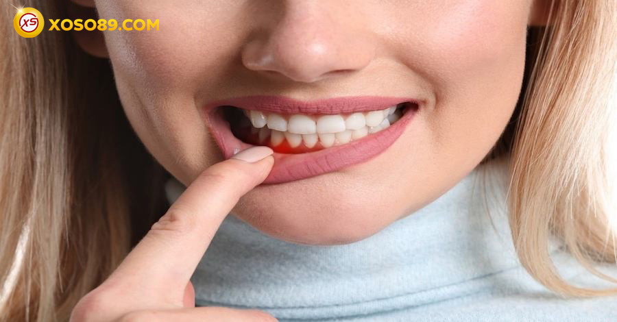 Nằm mơ thấy rụng răng đánh số mấy và báo điềm gì sẽ tới? 10 Mơ thấy rụng răng chảy máu có phải xui xẻo?
