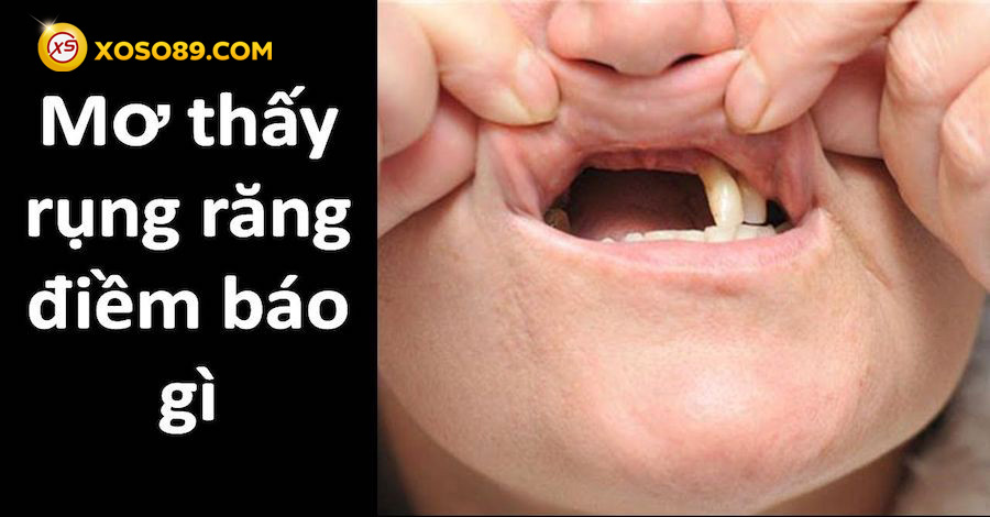 Nằm mơ thấy rụng răng đánh số mấy và báo điềm gì sẽ tới? 8 Mơ thấy rụng răng có liên quan gì đến tương lai?