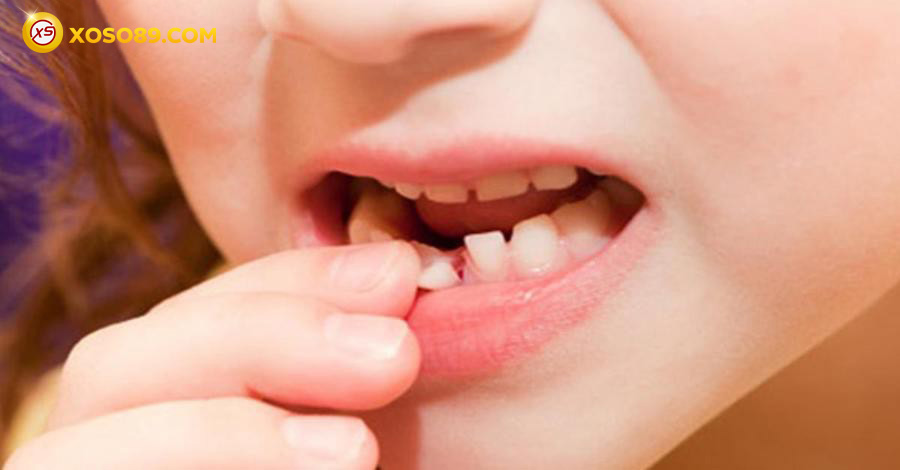 Nằm mơ thấy rụng răng đánh số mấy và báo điềm gì sẽ tới? 7 Rụng răng là một trải nghiệm đáng sợ trong mơ